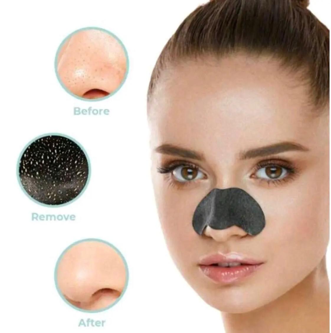 Removedor de Puntos Negros + Máscara nasal + Aguja quita puntos negros