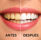 Kit de Blanqueamiento Dental