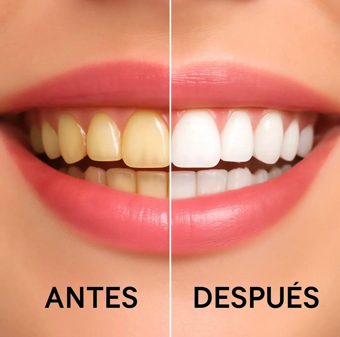 Kit de Blanqueamiento Dental